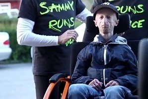  Невероятната история на Сами Басо - момчето, родено като старец. 