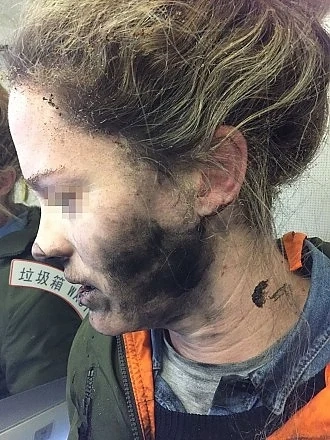 Жена пострада в самолет, след като слушалките й избухнаха  