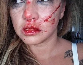 ПЕВИЦАТА САНИ АЛЕКСА Е ЖЕСТОКО ПРЕБИТА ОТ ГАДЖЕТО Й – ШВЕД