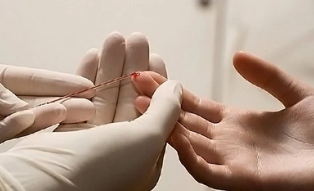Близо 100 000 българи с хепатит С не се лекуват