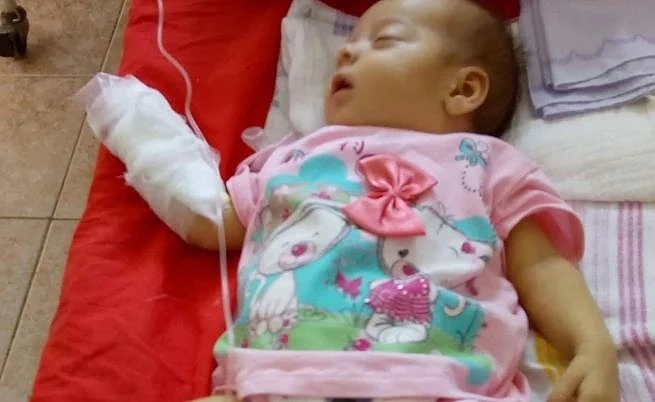 Бебе, родено без жлъчка, има нужда от спешна операция