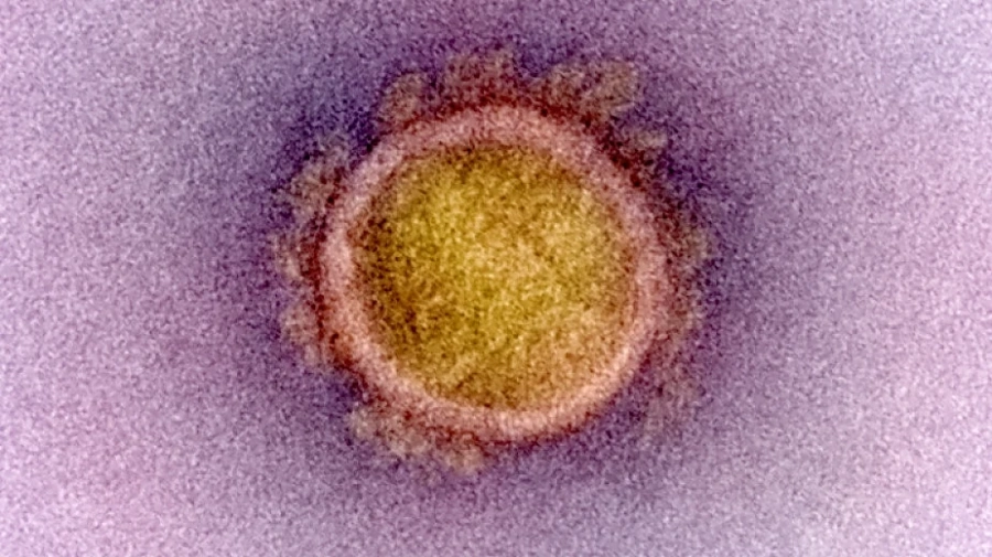 Няма нови потвърдени случаи на Covid-19 у нас 