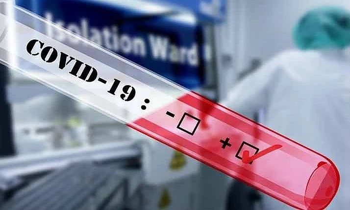 593 са потвърдените случаи на COVID-19 у нас