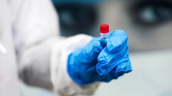 461 лица с доказан COVID-19 у нас са вече излекувани