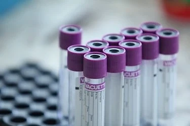 Ръст на броя на заразените с коронавирус за последното денонощие у нас