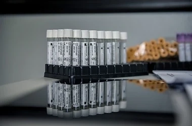 По света: Заразените с COVID-19 надминаха 8 млн. души 
