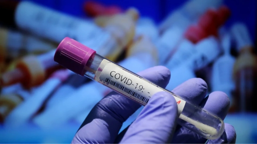89 са новите случаи на COVID-19 у нас, трима души са починали