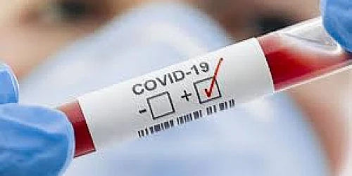 Ръст на заразените с COVID-19 - 117 нови случая и 6 починали