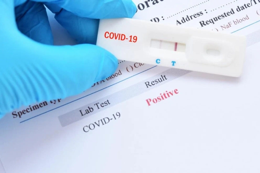 234 са новите случаи на COVID-19 у нас, 7 са починалите