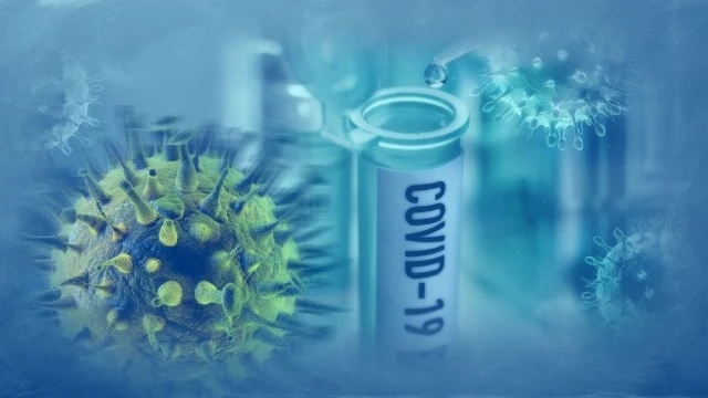 Данъчните подхванаха лабораториите заради тестовете за COVID-19