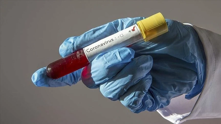COVID-19 взе 7 жертви у нас