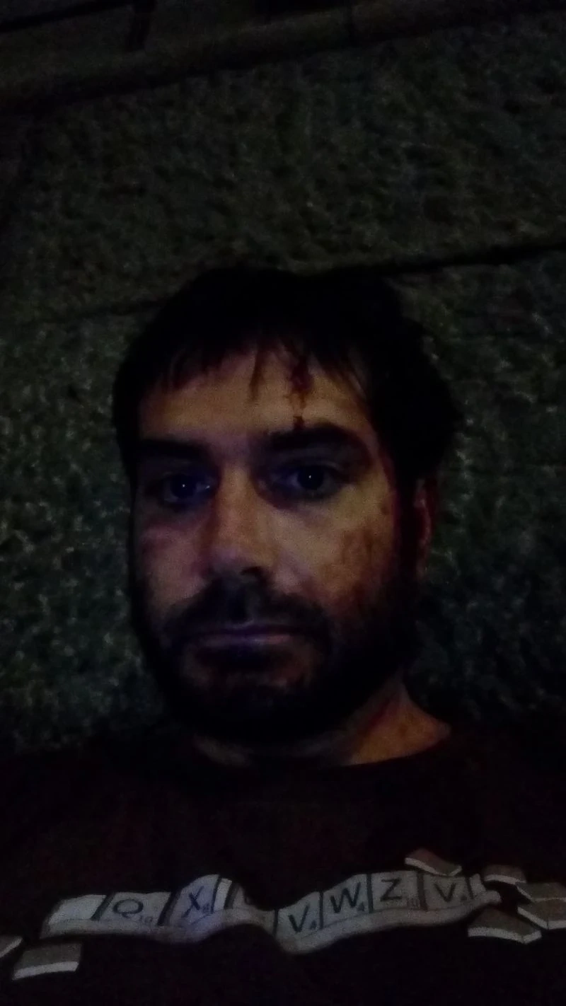 Журналистът Димитър Кенаров е ритан брутално в главата от полицаи, лежал с часове на паважа