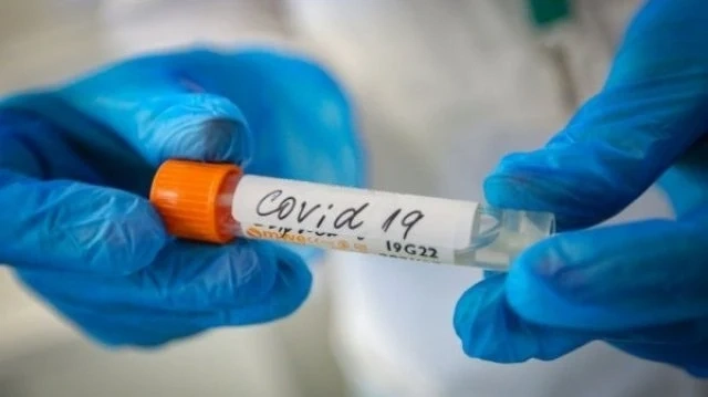 1 078 нови случая на COVID-19 у нас