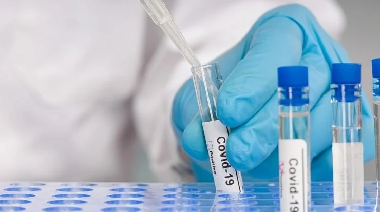 COVID-19 у нас: 200 нови случаи за последното денонощие, 4 души са починали