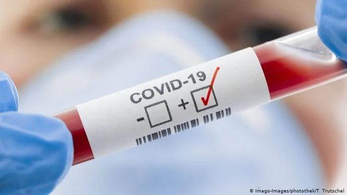 Нови случаи на COVID-19 у нас са 196