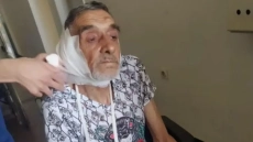 Близки на 63-годишен мъж твърдят, че е пребит от кмет на плевенско село 