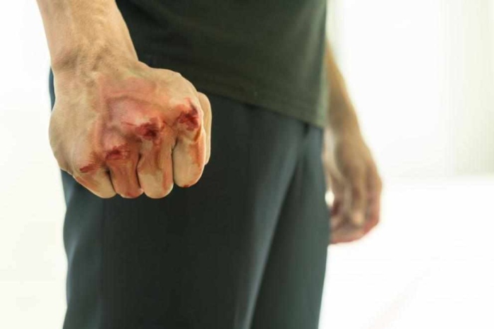 Мъже пребиха спасител на басейн в хотел в Хасково заради забележка